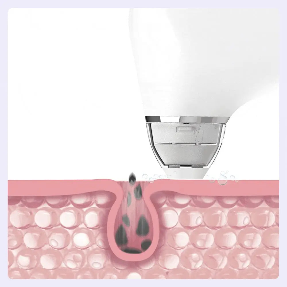 Electric Pore Vacuum & Blackhead Remover