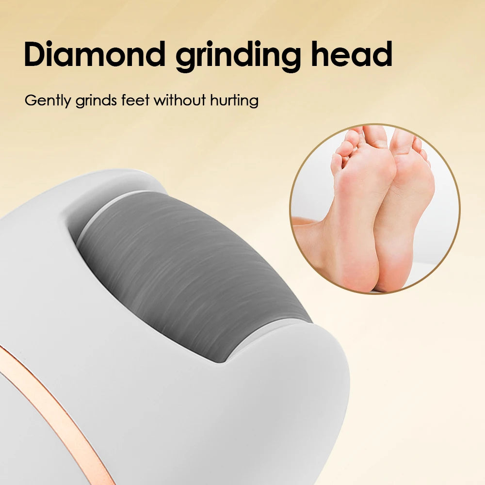 Electric Foot Callus Remover – USB Rechargeable