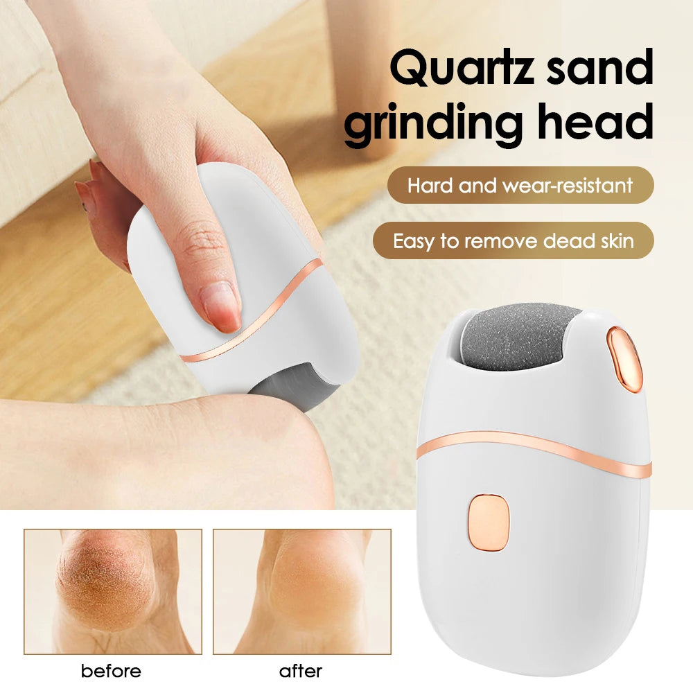 Electric Foot Callus Remover – USB Rechargeable